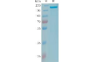 Complement Factor H Protein (CFH) (AA 19-1231) (His tag)