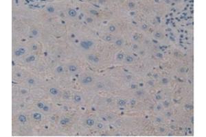 Figure. (CTHRC1 antibody  (AA 31-243))