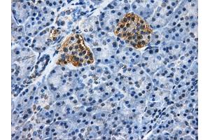 Immunohistochemical staining of paraffin-embedded pancreas tissue using anti-HDAC10mouse monoclonal antibody. (HDAC10 antibody)