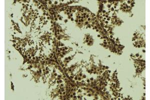 ABIN6277233 at 1/100 staining Mouse testis tissue by IHC-P. (EEF1D antibody)