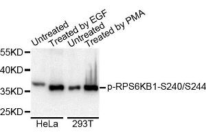 Western blot analysis of extracts of various cell lines, using Phospho-RPS6KB1-S240/244 antibody. (RPS6KB1 antibody)