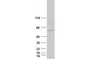 Validation with Western Blot (CD43 Protein (Transcript Variant 2) (Myc-DYKDDDDK Tag))