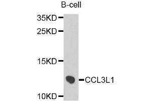 Western blot analysis of extracts of B-cell cells, using CCL3L1 antibody. (CCL3L1 antibody)