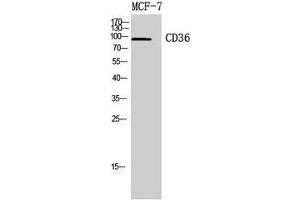 Western Blot analysis of MCF7, 4T1 cells with CD36 Polyclonal Antibody. (CD36 antibody)