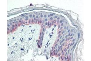 Immunohistochemical analysis of paraffin-embedded human skin tissues using CK5 antibody. (Cytokeratin 5 antibody)