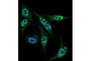 Immunofluorescence (IF) image for anti-Inner Centromere Protein Antigens 135/155kDa (INCENP) (AA 369-583) antibody (ABIN969529)