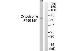 Western blot analysis of extracts from 293 cells, using CYP8B1 antibody. (CYP8B1 antibody  (Internal Region))