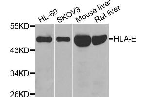 Western blot analysis of extracts of various cell lines, using HLA-E antibody (ABIN6290470) at 1:1000 dilution. (HLA-E antibody)