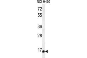 Western Blotting (WB) image for anti-Ribosomal Protein S13 (RPS13) antibody (ABIN3002137) (RPS13 antibody)