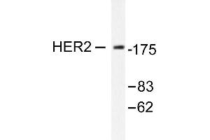 Image no. 1 for anti-Receptor tyrosine-protein kinase erbB-2 (ErbB2/Her2) antibody (ABIN265463) (ErbB2/Her2 antibody)