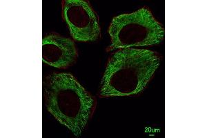 Immunofluorescence (IF) image for anti-Tubulin, beta (TUBB) antibody (ABIN5014943) (TUBB antibody)