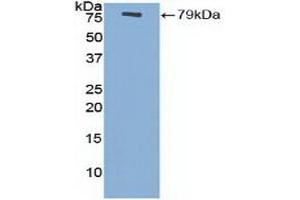 Detection of Recombinant MSE, Gallus using Polyclonal Antibody to Enolase 3 (ENO3) (ENO3 antibody  (AA 1-434))
