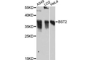 Western blot analysis of extracts of various cell lines, using BST2 antibody (ABIN5997322) at 1:3000 dilution. (BST2 antibody)