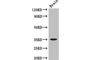 Western Blot Positive WB detected in: Mouse brain tissue All lanes: MYOD1 antibody at 3 μg/mL Secondary Goat polyclonal to rabbit IgG at 1/50000 dilution Predicted band size: 35 kDa Observed band size: 35 kDa (MYOD1 antibody  (AA 116-320))