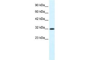 WB Suggested Anti-COLQ Antibody Titration:  0. (COLQ antibody  (N-Term))