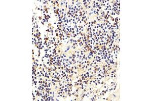 Iunohistochemical analysis of paraffin-embedded H. (MME antibody  (N-Term))