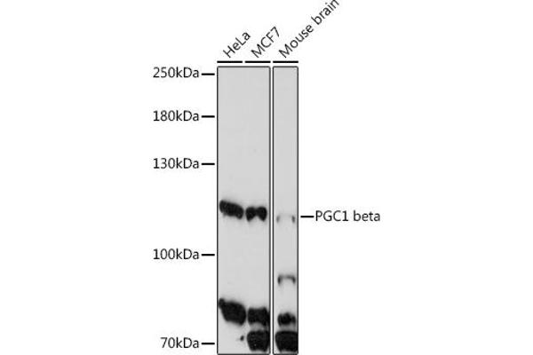 PPARGC1B anticorps  (AA 850-950)