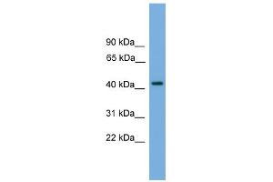 WB Suggested Anti-PALM Antibody Titration: 0. (Paralemmin antibody  (N-Term))