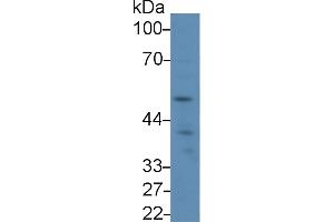 Detection of LAG3 in Human Jurkat cell lysate using Polyclonal Antibody to Lymphocyte Activation Gene 3 (LAG3) (LAG3 antibody  (AA 244-487))