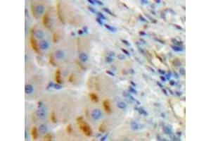 Used in DAB staining on fromalin fixed paraffin-embedded Liver tissue (CD79a antibody  (AA 30-193))