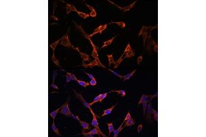 Immunofluorescence analysis of NIH/3T3 cells using HLA-DPB1 antibody (ABIN7268370) at dilution of 1:100. (HLA-DPB1 antibody)