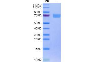 Biotinylated Human IL-22R alpha 1&IL-10R beta on Tris-Bis PAGE under reduced condition. (IL-22R alpha 1 & IL-10R beta (AA 16-228) protein (Fc-Avi Tag,Biotin))