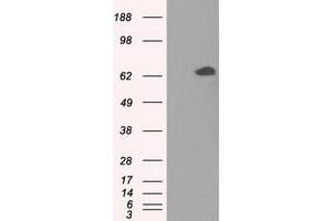 Image no. 2 for anti-Glucose-6-Phosphate Isomerase (GPI) antibody (ABIN1498505) (GPI antibody)