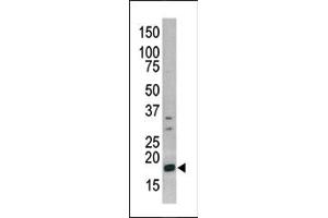 Image no. 1 for anti-Histone 3 (H3) (pSer10) antibody (ABIN358062) (Histone 3 antibody  (pSer10))