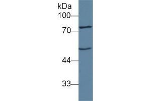 Detection of ANGPT1 in Mouse Liver lysate using Polyclonal Antibody to Angiopoietin 1 (ANGPT1) (Angiopoietin 1 antibody  (AA 21-228))