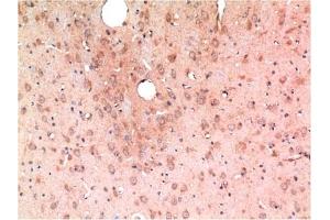 Immunohistochemical analysis of paraffin-embedded Rat Brain Tissue using TGFβ1 Mouse mAb diluted at 1:200. (TGFB1 antibody)