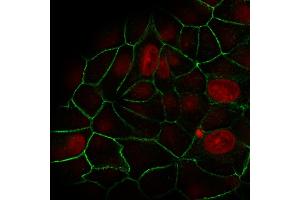 Immunofluorescence (IF) image for anti-Cadherin 1, Type 1, E-Cadherin (Epithelial) (CDH1) antibody (ABIN6941298)