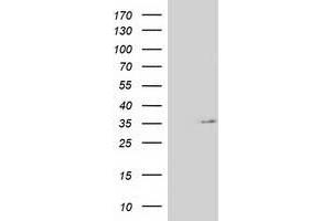 Western Blotting (WB) image for anti-Nudix (Nucleoside Diphosphate Linked Moiety X)-Type Motif 6 (NUDT6) antibody (ABIN1499870) (NUDT6 antibody)