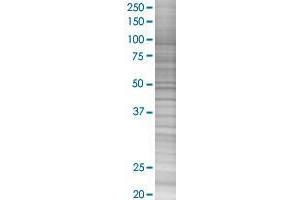 EXOSC1 transfected lysate. (EXOSC1 293T Cell Transient Overexpression Lysate(Denatured))