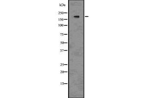 Western blot analysis of BRG1 using 293 whole cell lysates (SMARCA4 antibody  (N-Term))