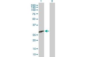 Western Blot analysis of CCBE1 expression in transfected 293T cell line by CCBE1 MaxPab polyclonal antibody. (CCBE1 antibody  (AA 1-215))