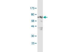 Western Blot detection against Immunogen (74. (TUBB2A antibody  (AA 1-445))