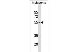 Western blot analysis in human placenta tissue lysates (35ug/lane). (TARBP2 antibody  (N-Term))