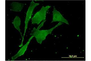 Immunofluorescence of monoclonal antibody to MBTPS2 on HeLa cell. (MBTPS2 antibody  (AA 312-418))