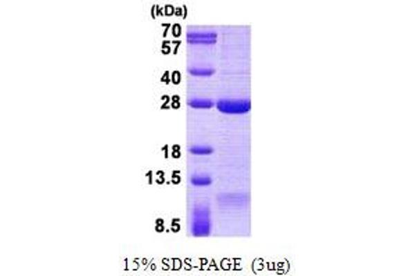 DNAL1 Protein (His tag)