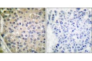Immunohistochemistry (IHC) image for anti-Protein Phosphatase 1, Regulatory (Inhibitor) Subunit 14A (PPP1R14A) (pThr38) antibody (ABIN2888390) (CPI-17 antibody  (pThr38))