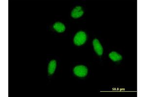 Immunofluorescence of purified MaxPab antibody to PIAS2 on HeLa cell. (PIAS2 antibody  (AA 1-572))