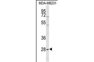 Western blot analysis of YIPF5 Antibody in MDA-MB231 cell line lysates (35ug/lane). (YIPF5 antibody  (N-Term))