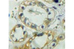 IHC-P analysis of Kidney tissue, with DAB staining. (PTPRM antibody  (AA 1197-1403))