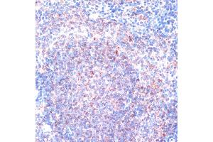 Immunohistochemistry of paraffin-embedded mouse spleen using RPS6K antibody (5718) at dilution of 1:100 (40x lens). (RPS6KA1 antibody  (C-Term))