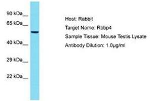 Image no. 1 for anti-Retinoblastoma Binding Protein 4 (RBBP4) (C-Term) antibody (ABIN6750365) (Retinoblastoma Binding Protein 4 antibody  (C-Term))