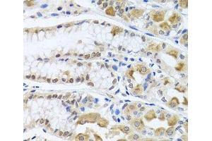 Immunohistochemistry of paraffin-embedded Human stomach using TRMT1 Polyclonal Antibody at dilution of 1:100 (40x lens). (TRMT1 antibody)