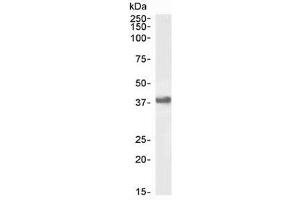 Western blot testing of human Daudi lysate with CD32 antibody at 1ug/ml. (FCGR2B antibody)