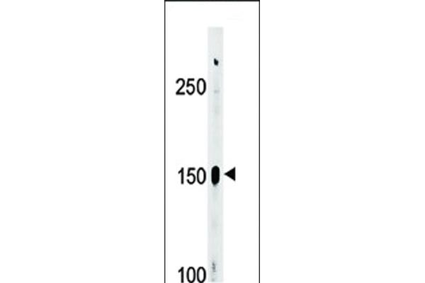 ABL2 antibody  (pTyr393, pTyr439)