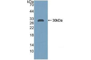 Western blot analysis of recombinant Rat CA2. (CA2 antibody)