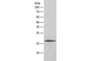 Western Blotting (WB) image for Gastrin-Releasing Peptide (GRP) (AA 1-172) protein (His tag) (ABIN7123059) (Gastrin-Releasing Peptide Protein (GRP) (AA 1-172) (His tag))